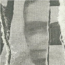 Overbite (2) : Overbite (7