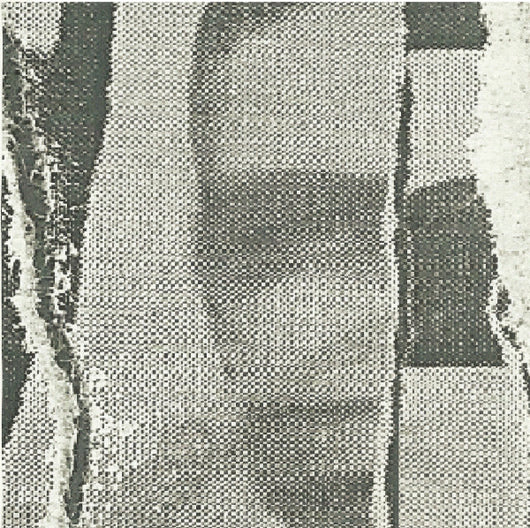 Overbite (2) : Overbite (7